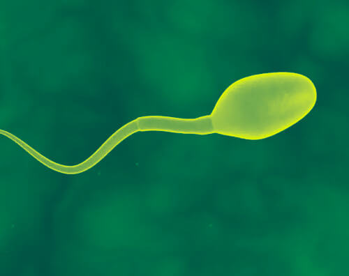 Assessment of sperm genome breakdown